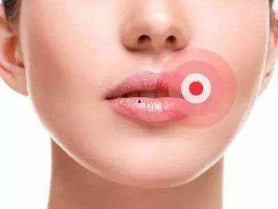 吃瓜嘴角疱疹,揭秘口腔健康危机